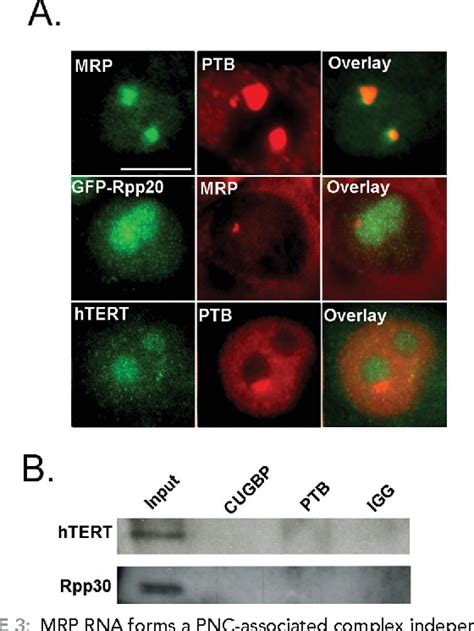 pnc protein|The Perinucleolar Compartment: RNA Metabolism and Cancer.